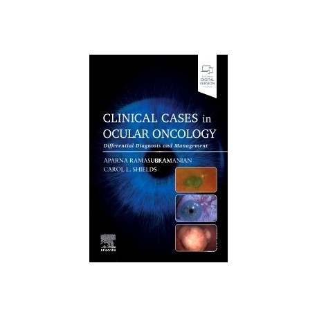 Clinical Cases in Ocular Oncology Differential Diagnosis and Management