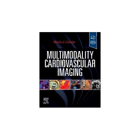 Multimodality Cardiovascular Imaging