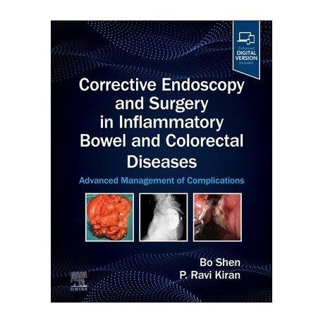 Corrective Endoscopy and Surgery in Inflammatory Bowel and Colorectal Diseases