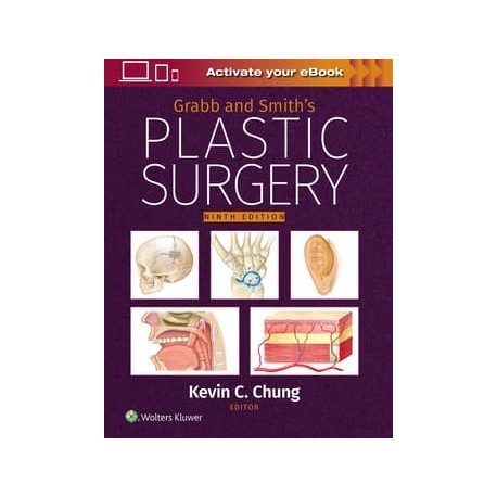 Grabb and Smith`s Plastic Surgery: Print + eBook with Multimedia,9 Edition