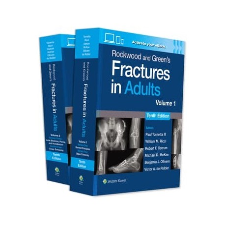 Rockwood and Green`s Fractures in Adults: Print + eBook with Multimedia 10th Edition