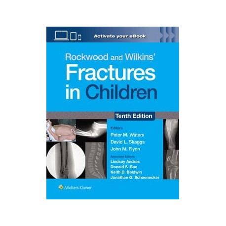 Rockwood and Wilkins` Fractures in Children: Print + eBook with Multimedia 10th Edition