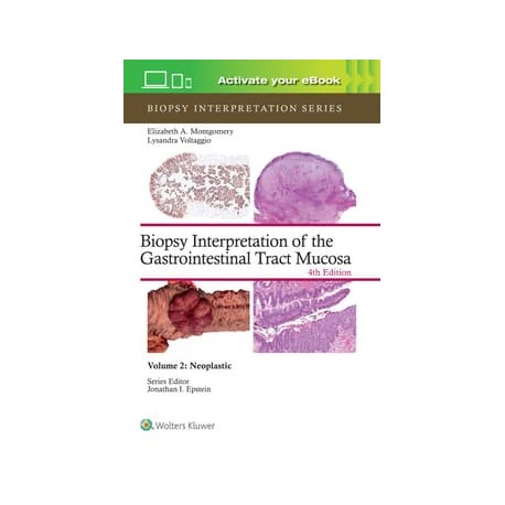 Biopsy Interpretation of the Gastrointestinal Tract Mucosa Volume 2