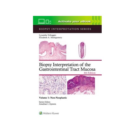 Biopsy Interpretation of the Gastrointestinal Tract Mucosa Volume 1