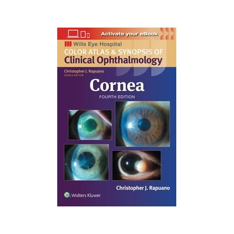 Cornea: Print + eBook with Multimedia,4 Edition