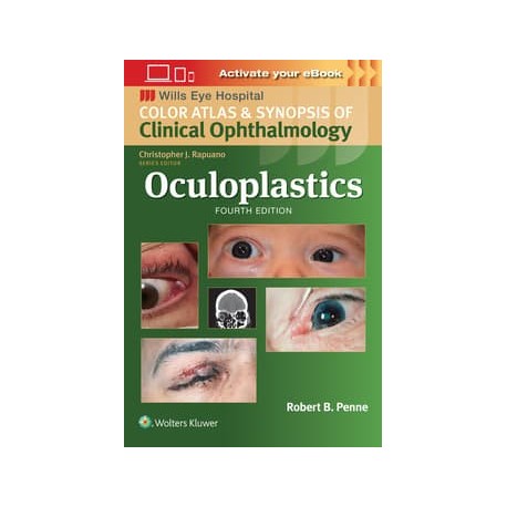 Oculoplastics,4 Edition