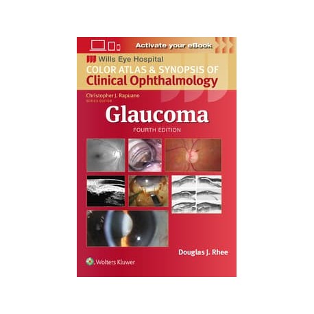 Glaucoma,4 Edition