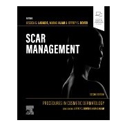 Procedures in Cosmetic Dermatology: Scar Management, 2nd Edition