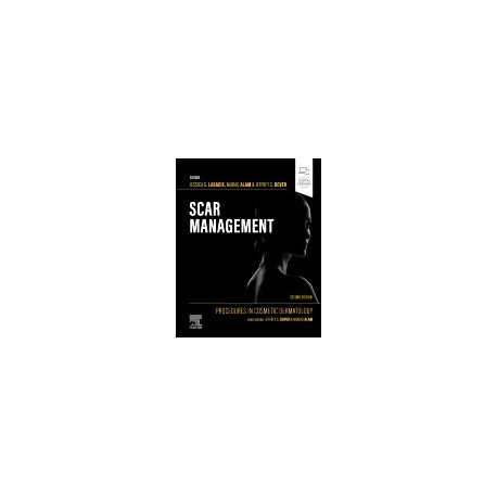 Procedures in Cosmetic Dermatology: Scar Management, 2nd Edition