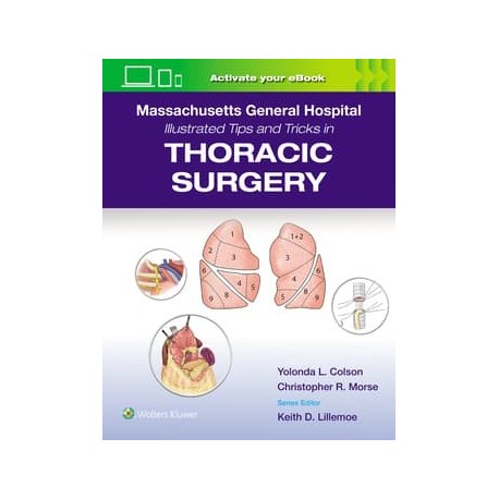 Massachusetts General Hospital Illustrated Tips and Tricks in Thoracic Surgery: Print + eBook with Multimedia