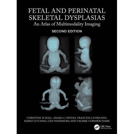 Fetal and Perinatal Skeletal Dysplasias An Atlas of Multimodality Imaging,2nd Edition