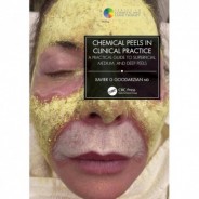 Chemical Peels in Clinical Practice A Practical Guide to Superficial, Medium, and Deep Peels