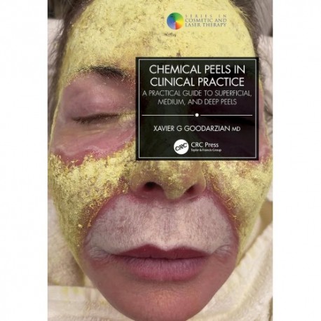 Chemical Peels in Clinical Practice A Practical Guide to Superficial, Medium, and Deep Peels