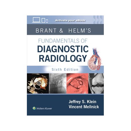 Brant & Helm's Fundamentals of Diagnostic Radiology: Print + eBook with Multimedia 6, Edition