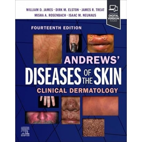 Andrews' Diseases of the Skin: Clinical Dermatology 14th Edition