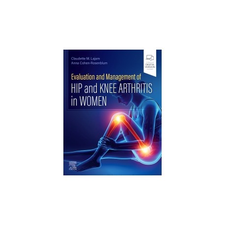 Evaluation and Management of Hip and Knee Arthritis in Women