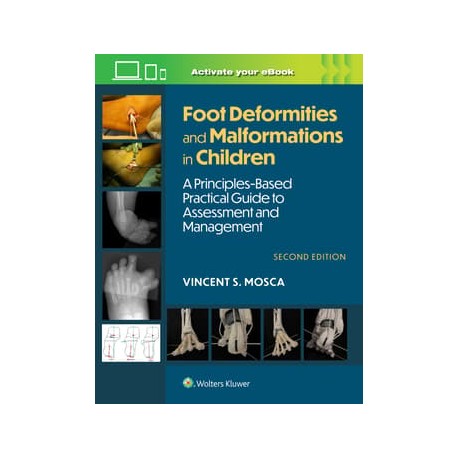 Foot Deformities and Malformations in Children: A Principles-Based, Practical Guide to Assessment and Management: Print + eBook with Multimedia, 2 Edition