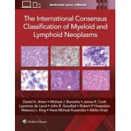 The International Consensus Classification of Myeloid and Lymphoid Neoplasms