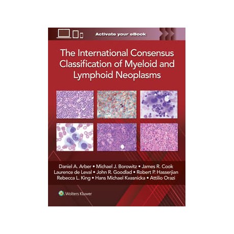 The International Consensus Classification of Myeloid and Lymphoid Neoplasms