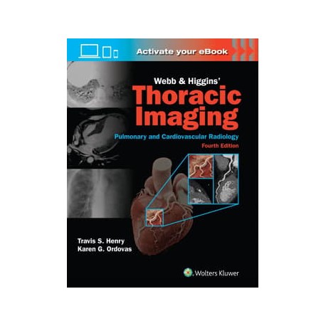 Webb & Higgins Thoracic Imaging: Print + eBook with Multimedia, 4th Edition