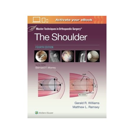 Master Techniques in Orthopaedic Surgery: The Shoulder, 4th Edition