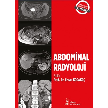 Abdominal Radyoloji 2. Baskı