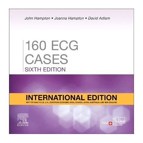 160 ECG Cases, International Edition, 6th Editio