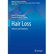 Hair Loss: Advances and Treatments