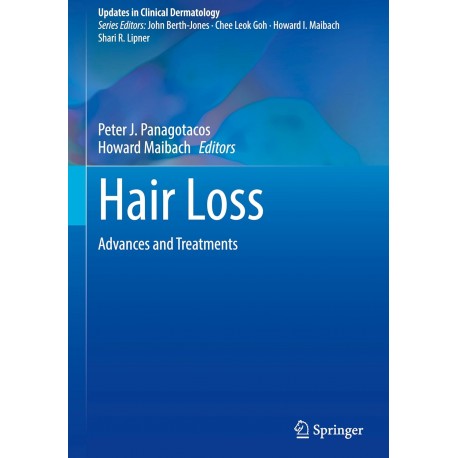 Hair Loss: Advances and Treatments