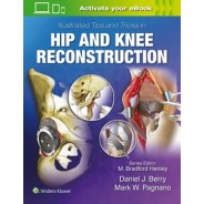 Illustrated Tips and Tricks in Hip and Knee Reconstructive and Replacement Surgery