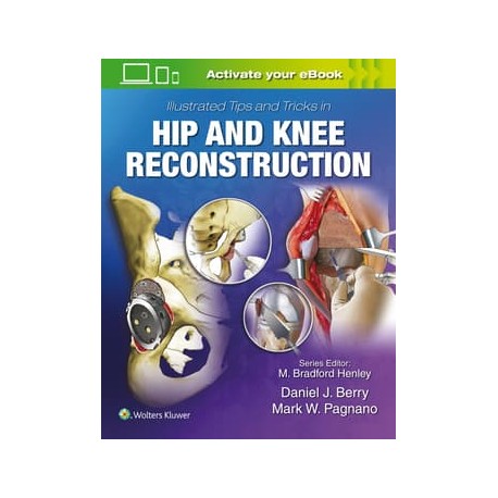 Illustrated Tips and Tricks in Hip and Knee Reconstructive and Replacement Surgery