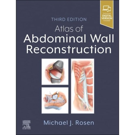 Atlas of Abdominal Wall Reconstruction, 3rd Edition